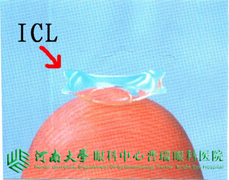 ICL植入術(shù)，高度近視患者的福音