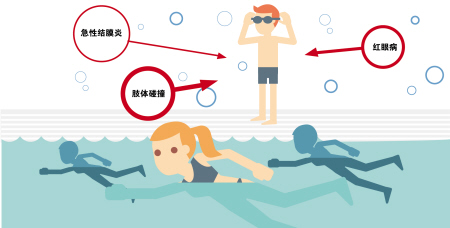 夏季當(dāng)心紅眼病，網(wǎng)吧泳池成高發(fā)區(qū)