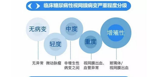 你造嗎？糖尿病晚期眼睛會致盲！