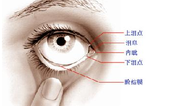 淚道病，眼部的隱形威脅