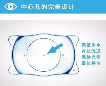 高度近視的“終結(jié)者”——ICL晶體植入術(shù)！