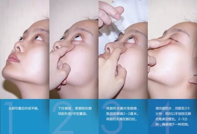 眼藥水你點(diǎn)對(duì)了嗎？快來(lái)看看！