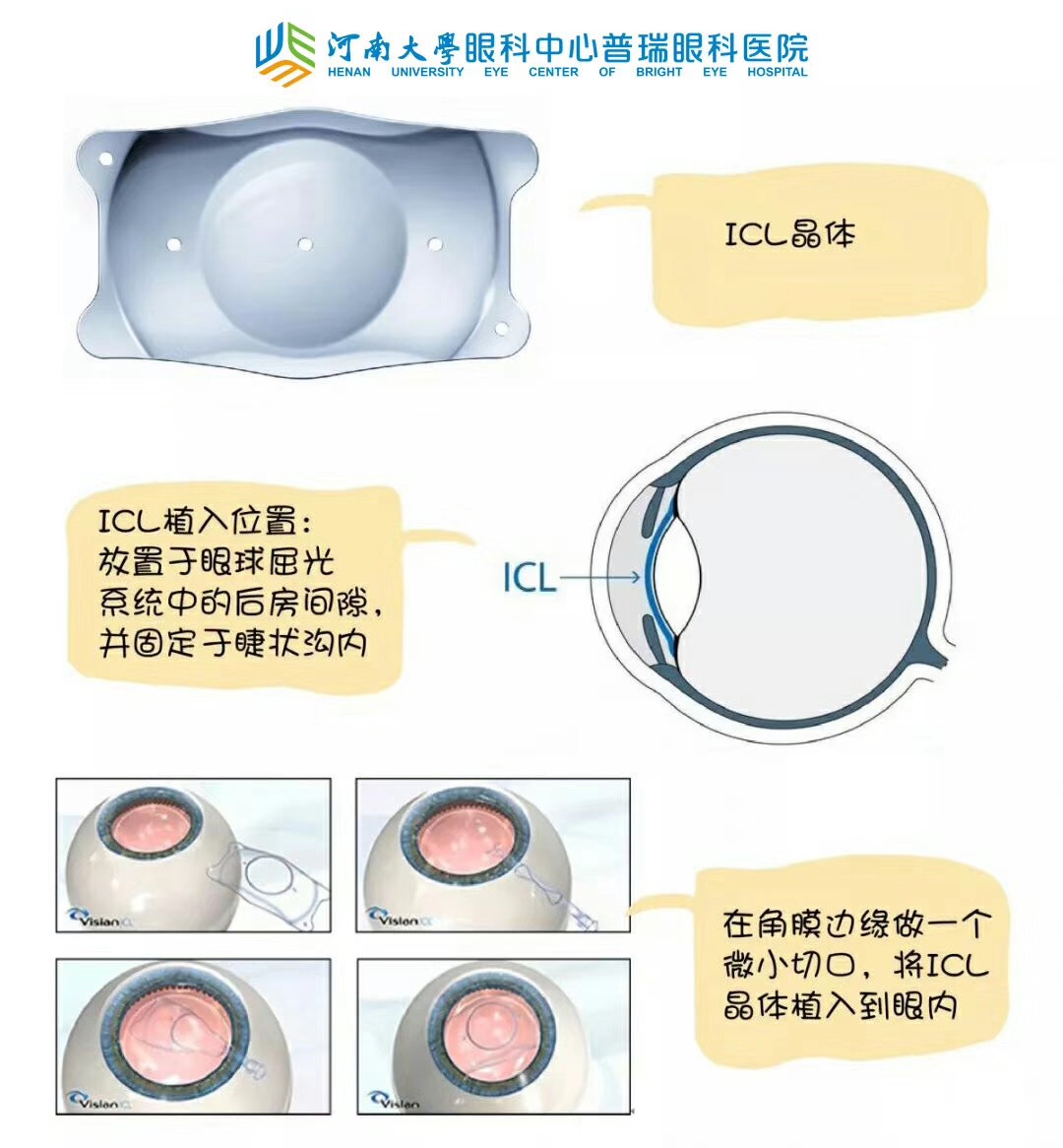 近視度數(shù)太高，還能做手術(shù)嗎？